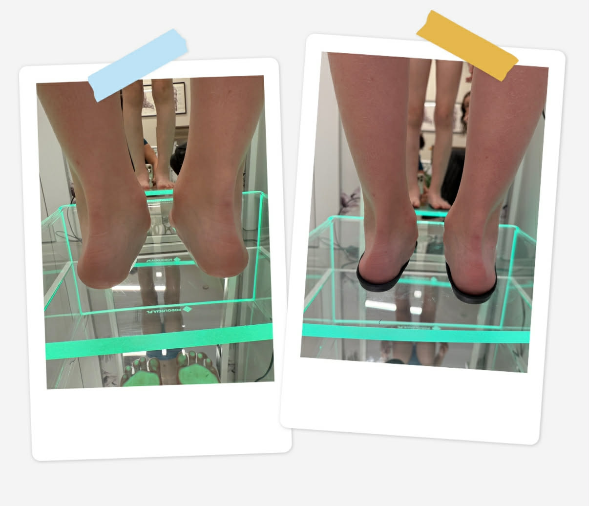 Przyczyny problemów stóp